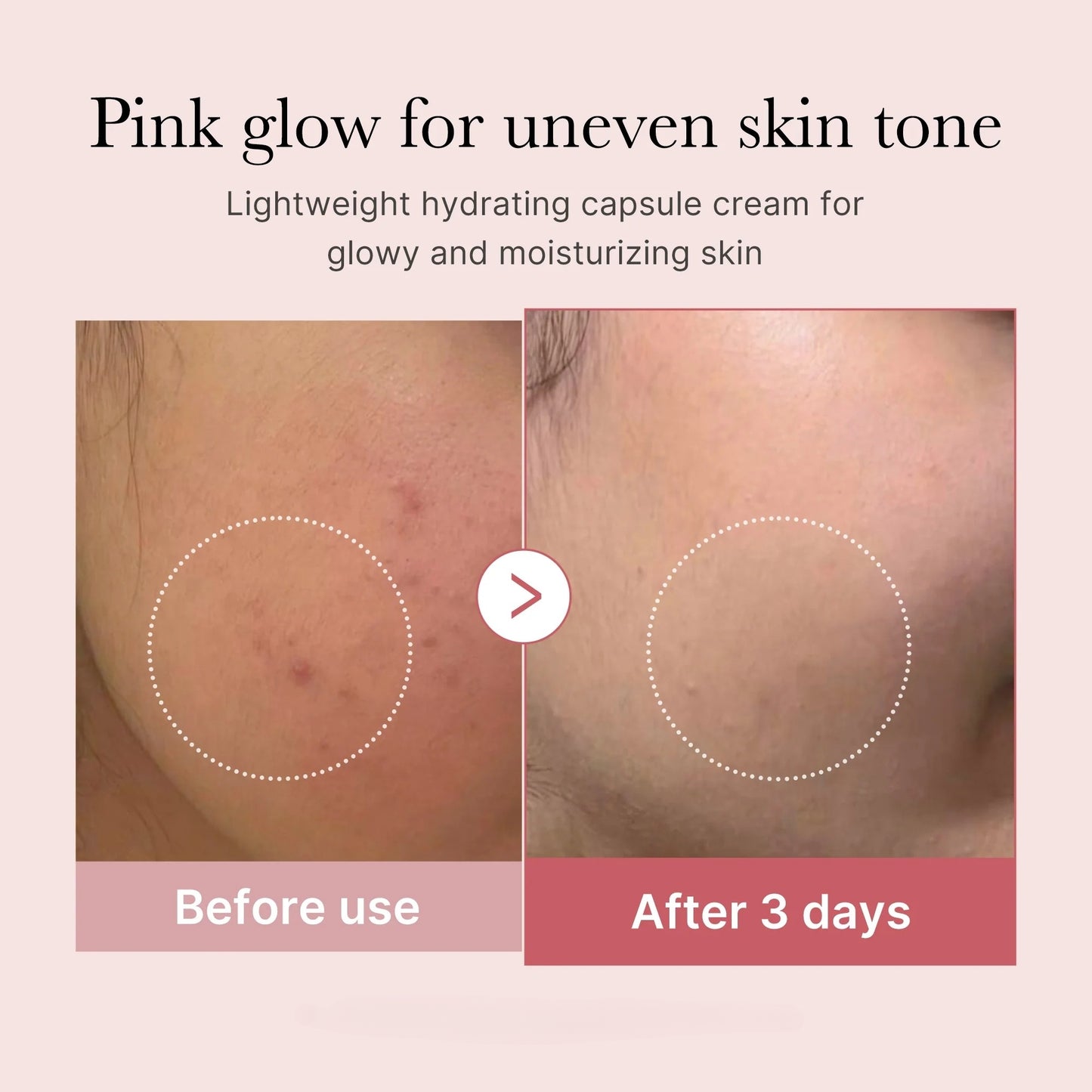 Pink PDRN Set